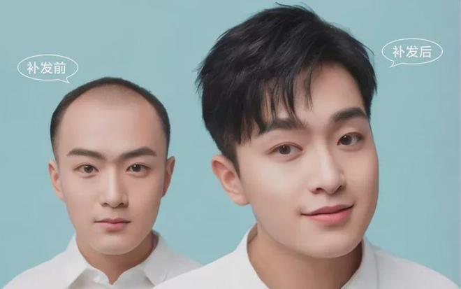 凯发k8国际娱乐官网入口|揭秘假发店隐形